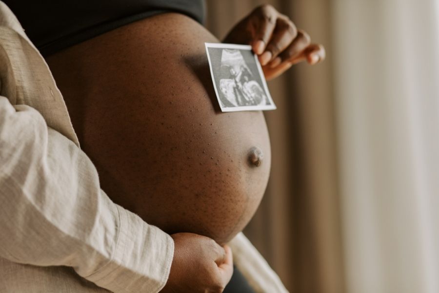Pregnant woman holding ultrasound photo on belly showcasing pregnancy safe bonding moments